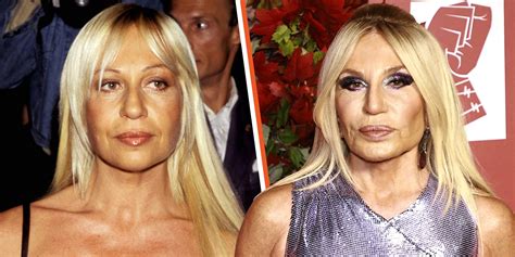 donatella versace before plastic surgery and after|Donatella Versace facelift.